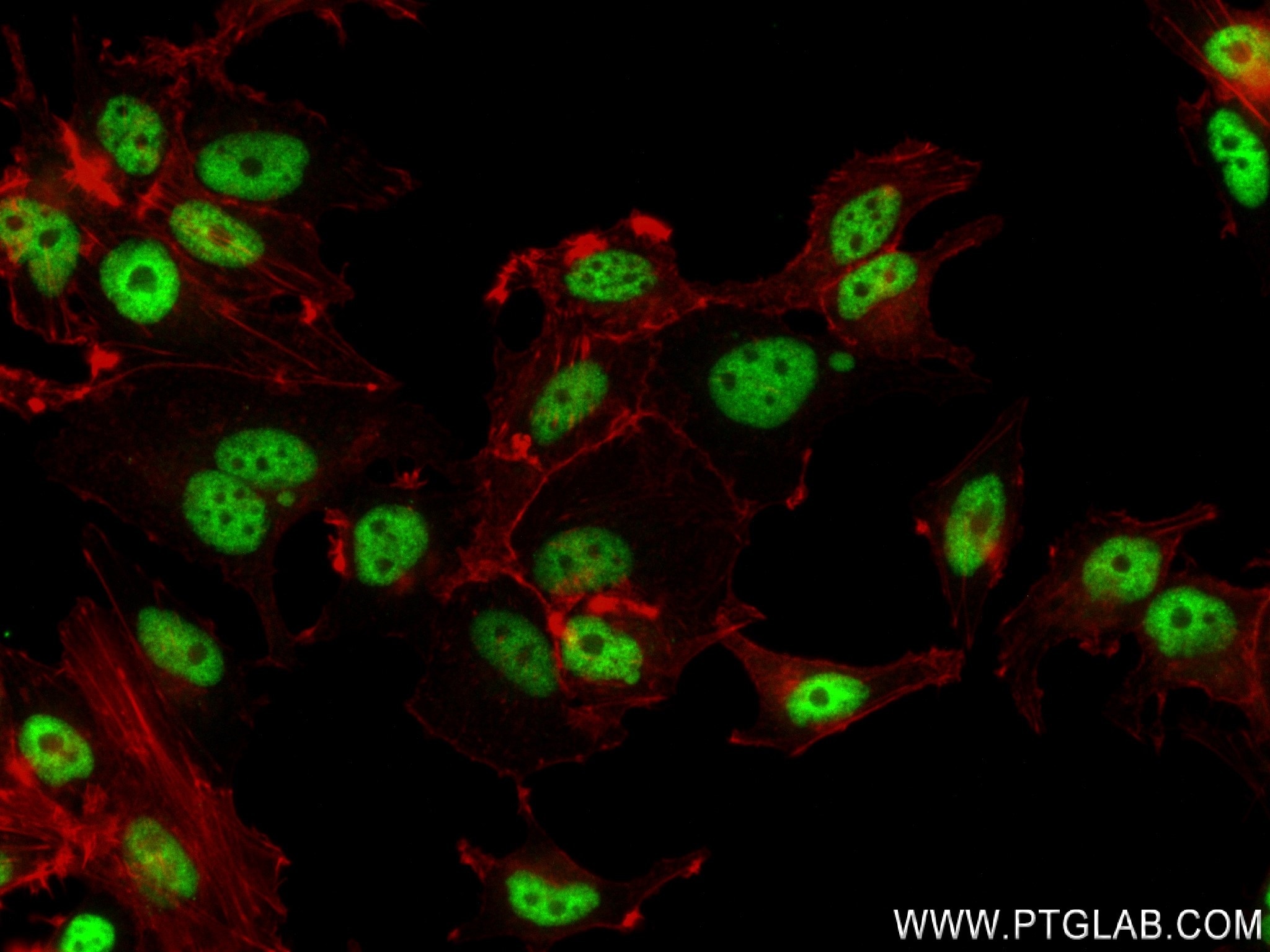 Immunofluorescence (IF) / fluorescent staining of MCF-7 cells using CRNKL1 Recombinant antibody (83914-1-RR)