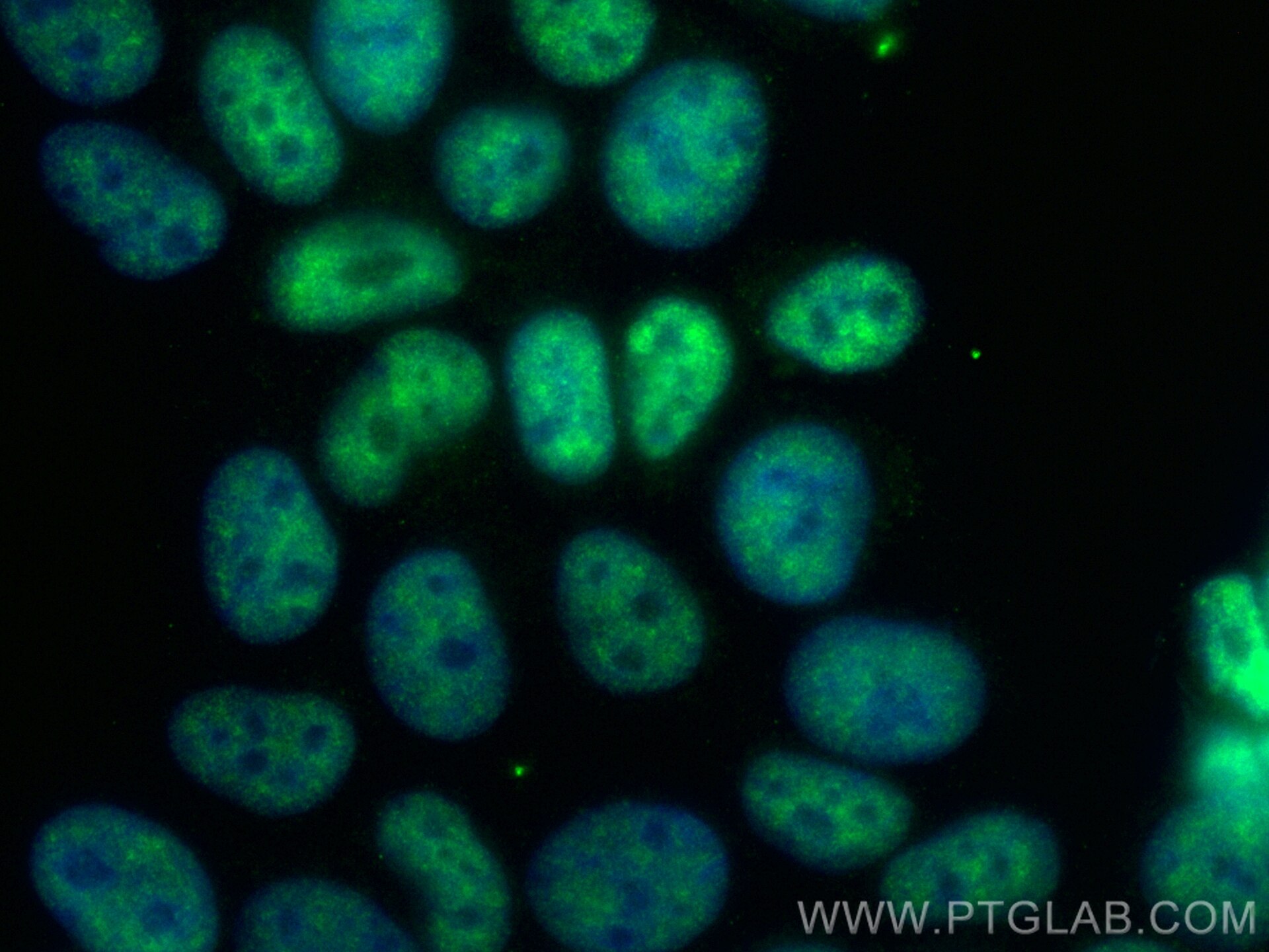 Immunofluorescence (IF) / fluorescent staining of MCF-7 cells using CoraLite® Plus 488-conjugated CRNKL1 Recombinant a (CL488-83914)