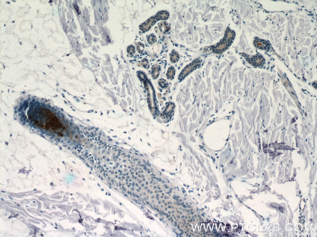 Immunohistochemistry (IHC) staining of human skin tissue using CRNN Polyclonal antibody (11799-1-AP)