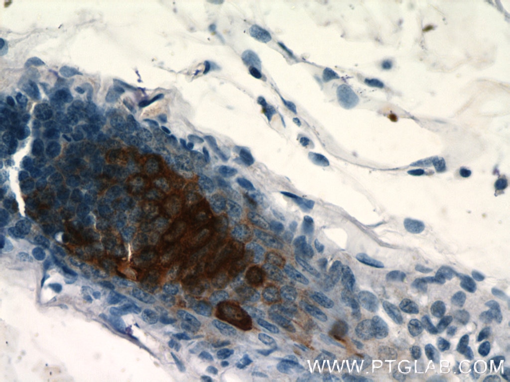 IHC staining of human skin using 11799-1-AP