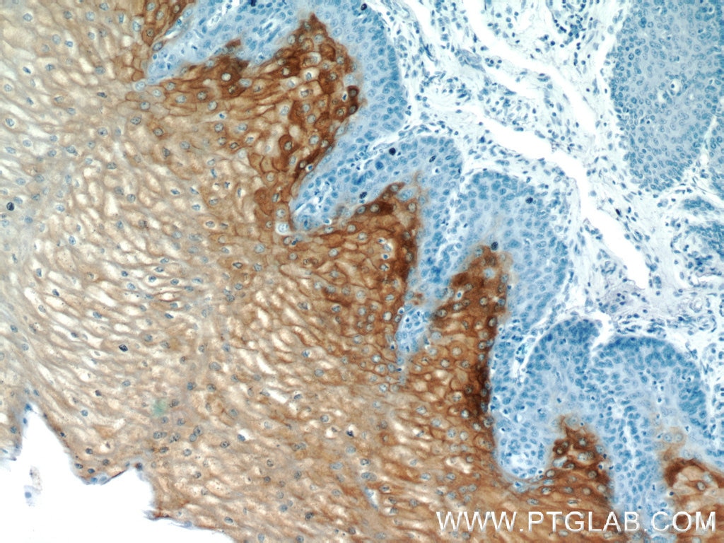 IHC staining of human oesophagus using 11799-1-AP