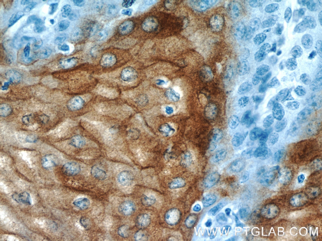 Immunohistochemistry (IHC) staining of human oesophagus tissue using CRNN Polyclonal antibody (11799-1-AP)