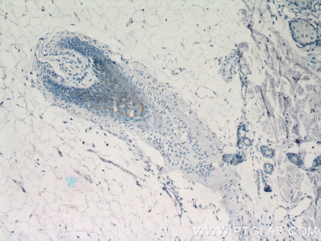 Immunohistochemistry (IHC) staining of human skin tissue using CRNN Polyclonal antibody (11799-1-AP)