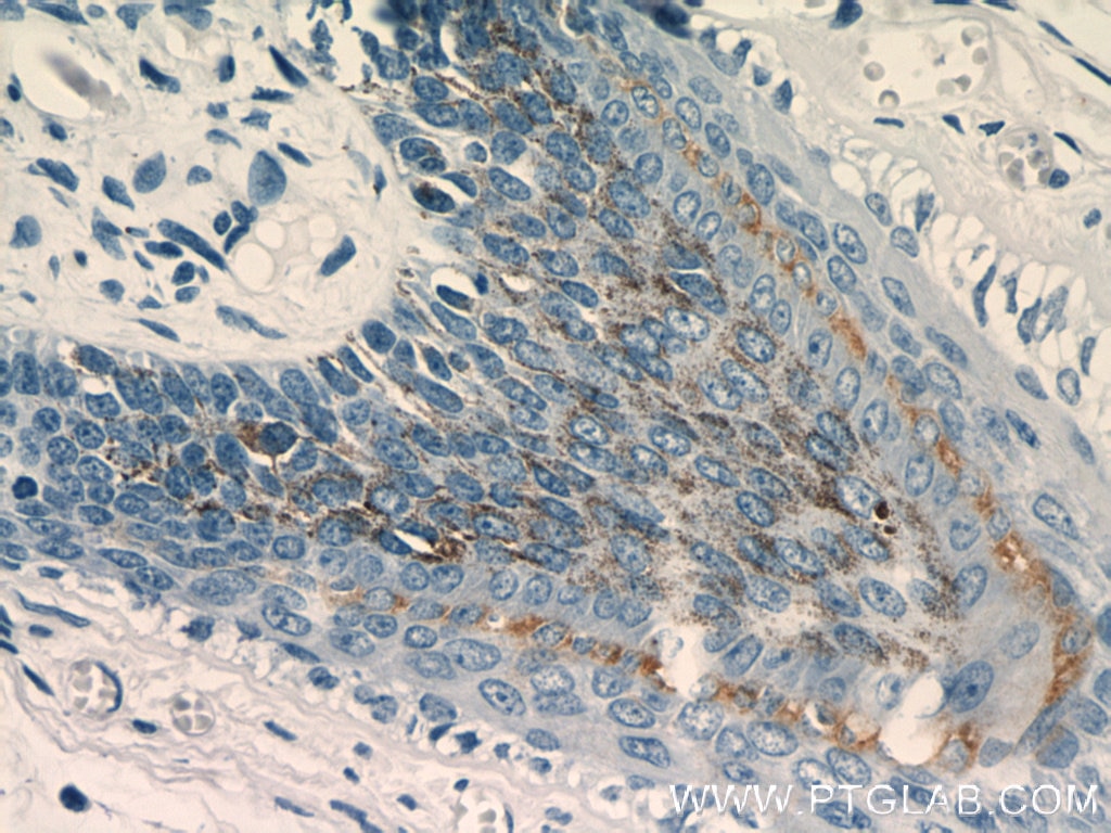 Immunohistochemistry (IHC) staining of human skin tissue using CRNN Polyclonal antibody (11799-1-AP)