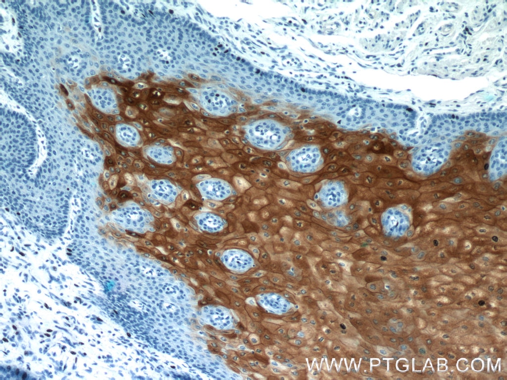 Immunohistochemistry (IHC) staining of human oesophagus tissue using CRNN Polyclonal antibody (11799-1-AP)