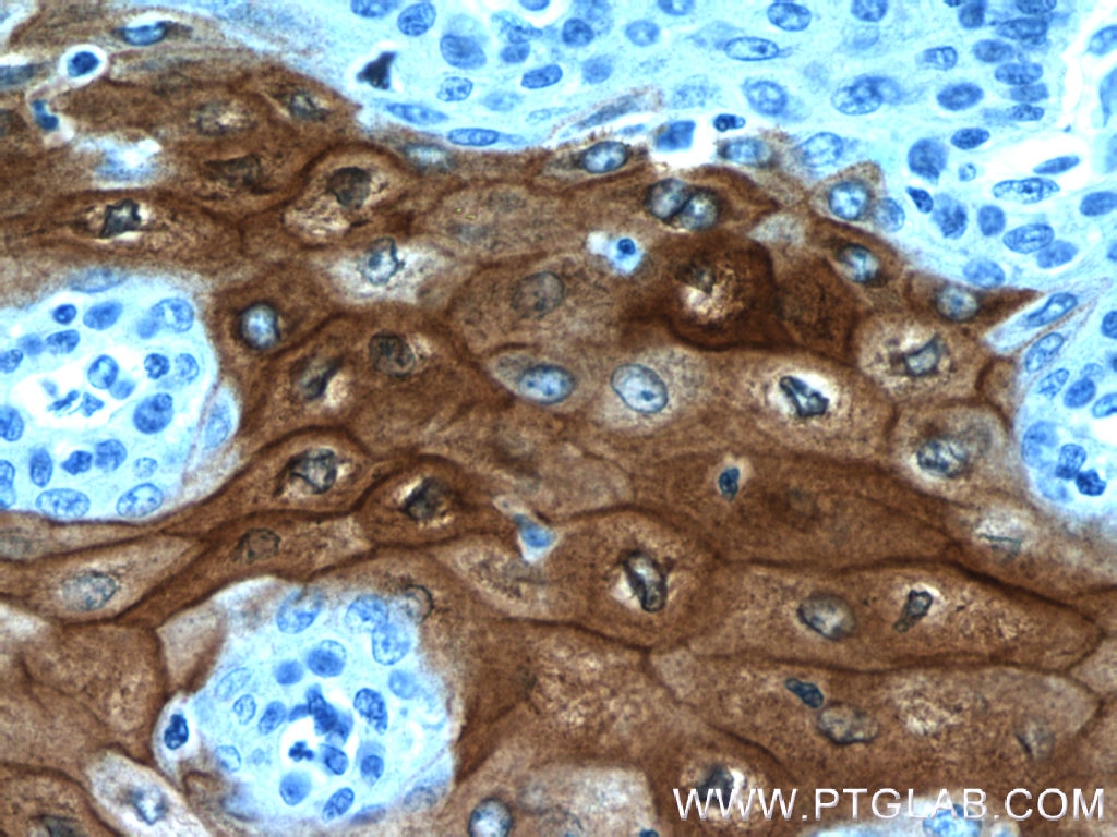 Immunohistochemistry (IHC) staining of human oesophagus tissue using CRNN Polyclonal antibody (11799-1-AP)