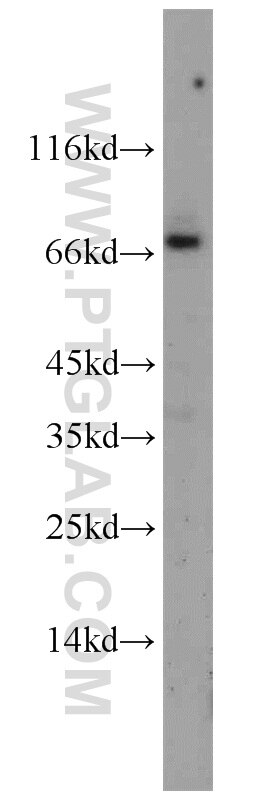 Western Blot (WB) analysis of mouse brain tissue using CRNN Polyclonal antibody (11799-1-AP)