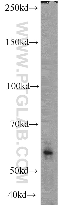 Western Blot (WB) analysis of HepG2 cells using CRNN Polyclonal antibody (11799-1-AP)