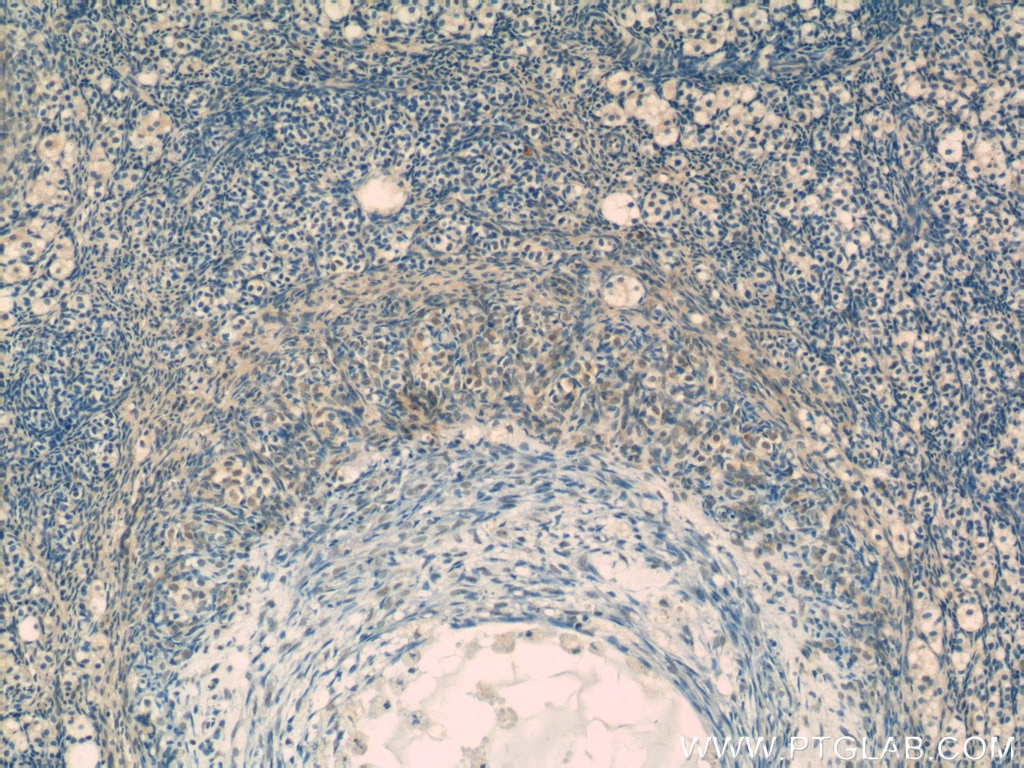 Immunohistochemistry (IHC) staining of human ovary tissue using CROP Polyclonal antibody (14504-1-AP)