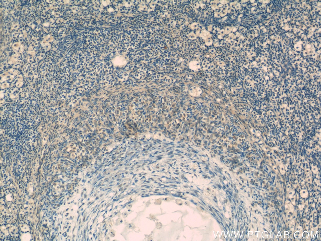 IHC staining of human ovary using 14504-1-AP