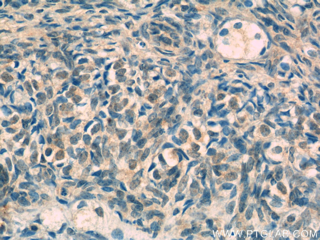 Immunohistochemistry (IHC) staining of human ovary tissue using CROP Polyclonal antibody (14504-1-AP)