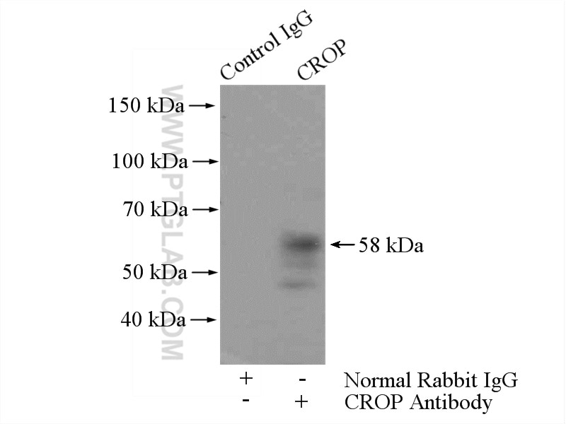 Immunoprecipitation (IP) experiment of HepG2 cells using CROP Polyclonal antibody (14504-1-AP)
