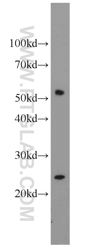 Western Blot (WB) analysis of Jurkat cells using CROP Polyclonal antibody (14504-1-AP)