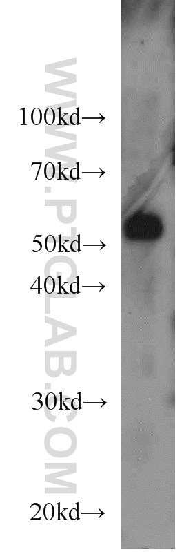 Western Blot (WB) analysis of mouse brain tissue using CROP Polyclonal antibody (14504-1-AP)