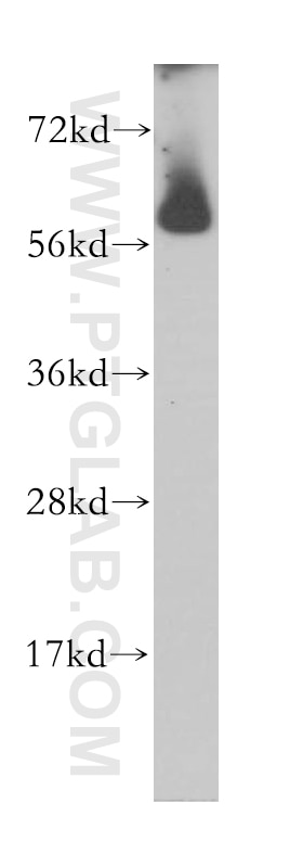 Western Blot (WB) analysis of HepG2 cells using CROP Polyclonal antibody (14504-1-AP)