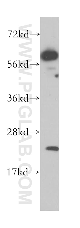 Western Blot (WB) analysis of Jurkat cells using CROP Polyclonal antibody (14504-1-AP)