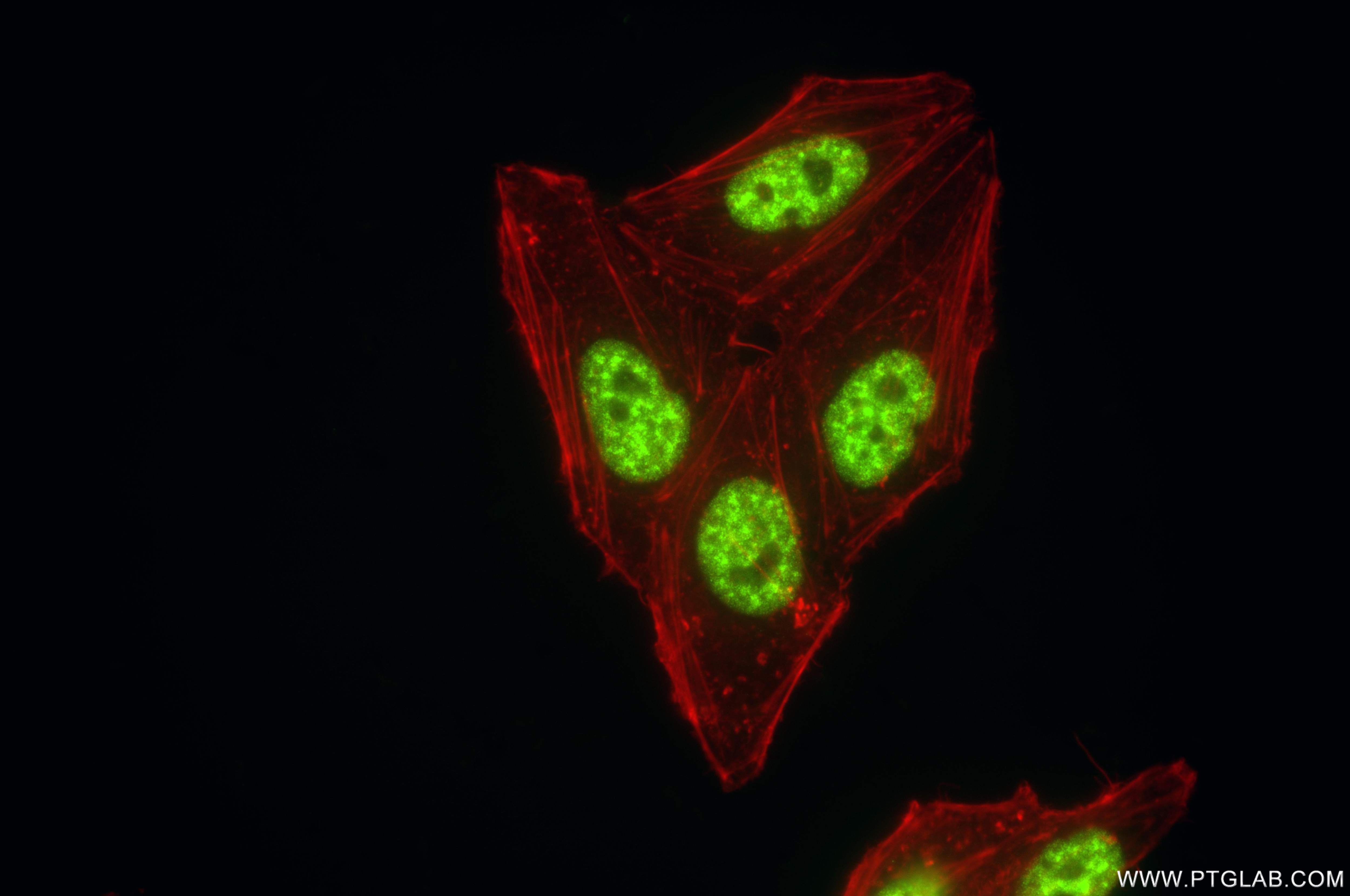 IF Staining of HepG2 using 86690-1-RR Immunofluorescence (IF) / fluorescent staining of HepG2 cells using CROP Recombinant monoclonal antibody (86690-1-RR)