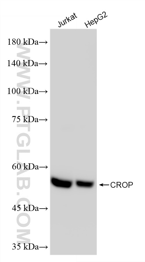 WB analysis using 86690-1-RR Western Blot (WB) analysis of various lysates using CROP Recombinant monoclonal antibody (86690-1-RR)