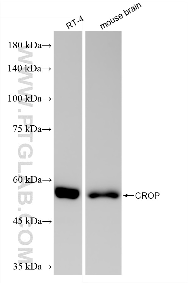 WB analysis using 86690-1-RR Western Blot (WB) analysis of various lysates using CROP Recombinant monoclonal antibody (86690-1-RR)
