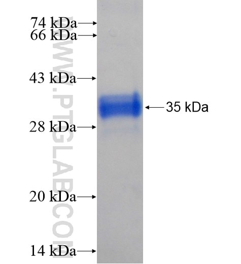 CROP fusion protein Ag5961 SDS-PAGE