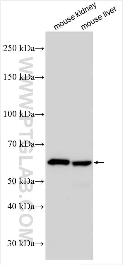 Western Blot (WB) analysis of various lysates using CROT Polyclonal antibody (13543-1-AP)