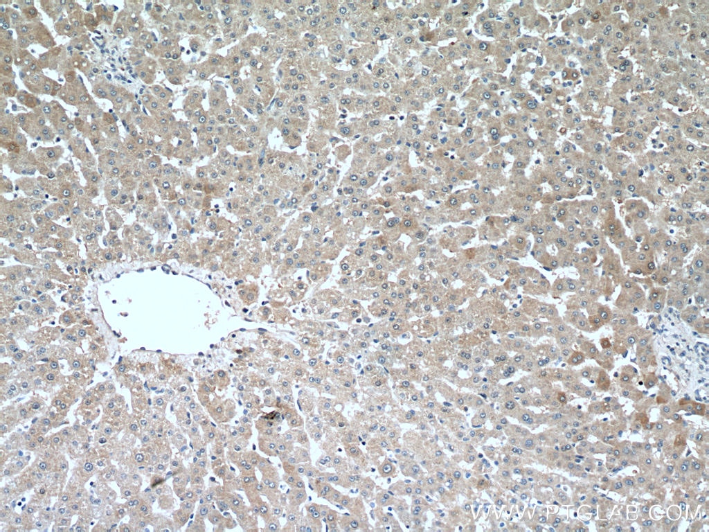 Immunohistochemistry (IHC) staining of human liver tissue using CRP Polyclonal antibody (24175-1-AP)
