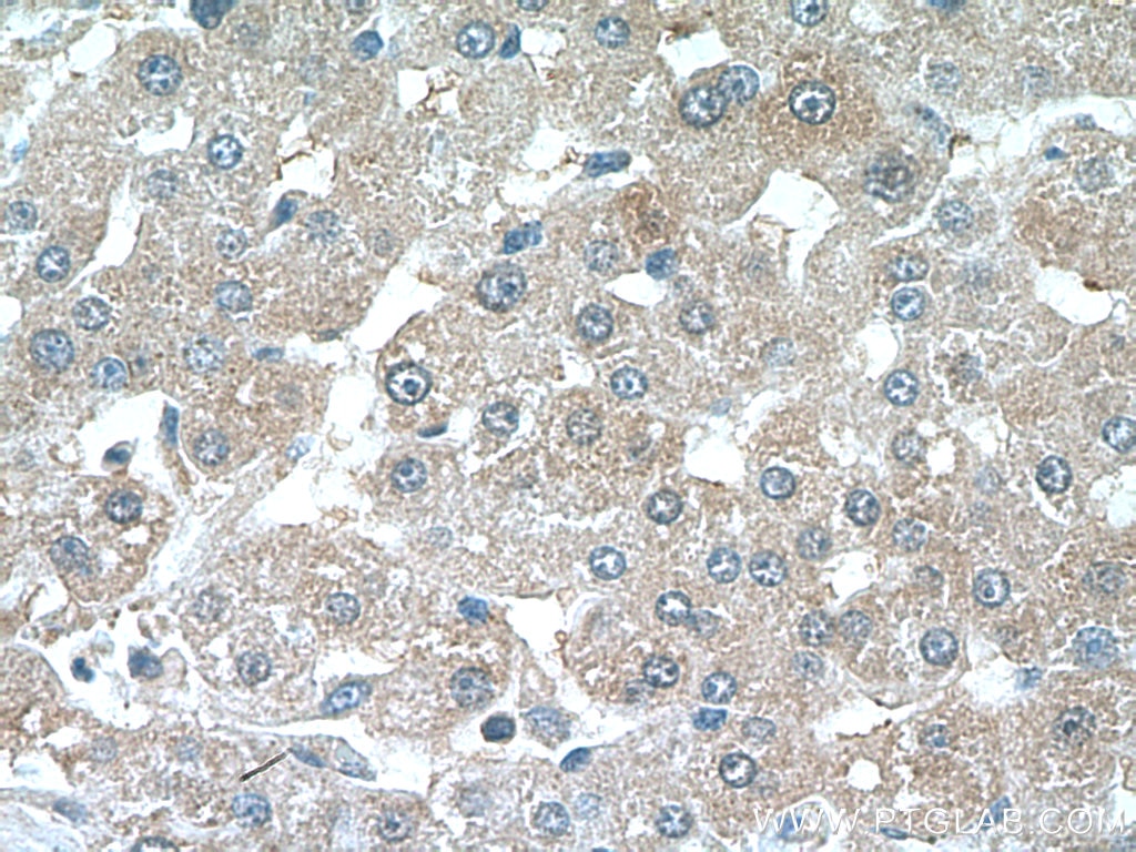 Immunohistochemistry (IHC) staining of human liver tissue using CRP Polyclonal antibody (24175-1-AP)