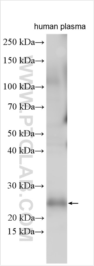 Western Blot (WB) analysis of human plasma using CRP Polyclonal antibody (24175-1-AP)
