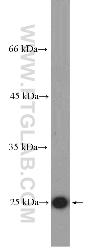 Western Blot (WB) analysis of serum from mouse injected with bacteria using CRP Polyclonal antibody (24175-1-AP)