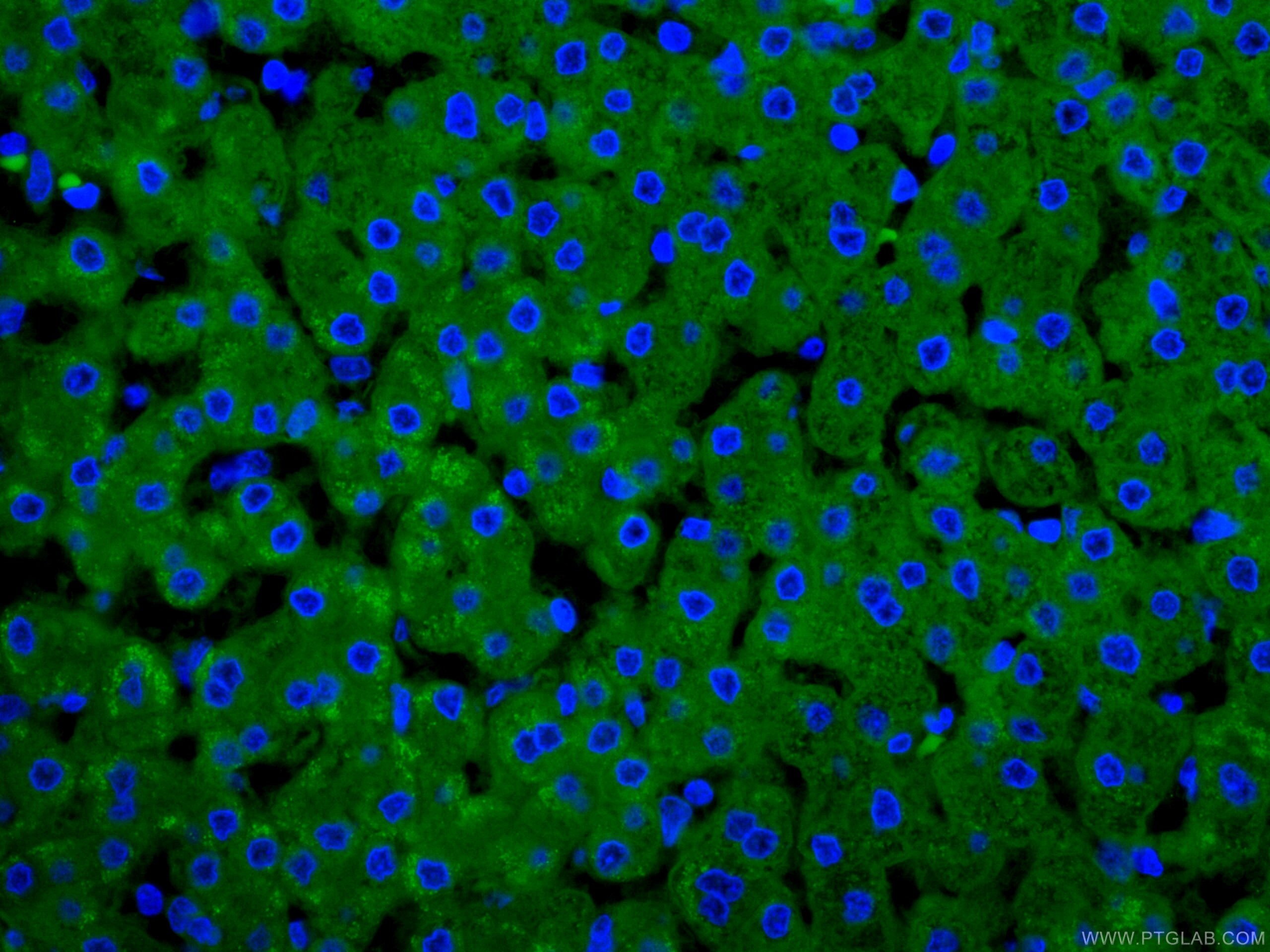 Immunofluorescence (IF) / fluorescent staining of human liver tissue using CRP Monoclonal antibody (66250-1-Ig)