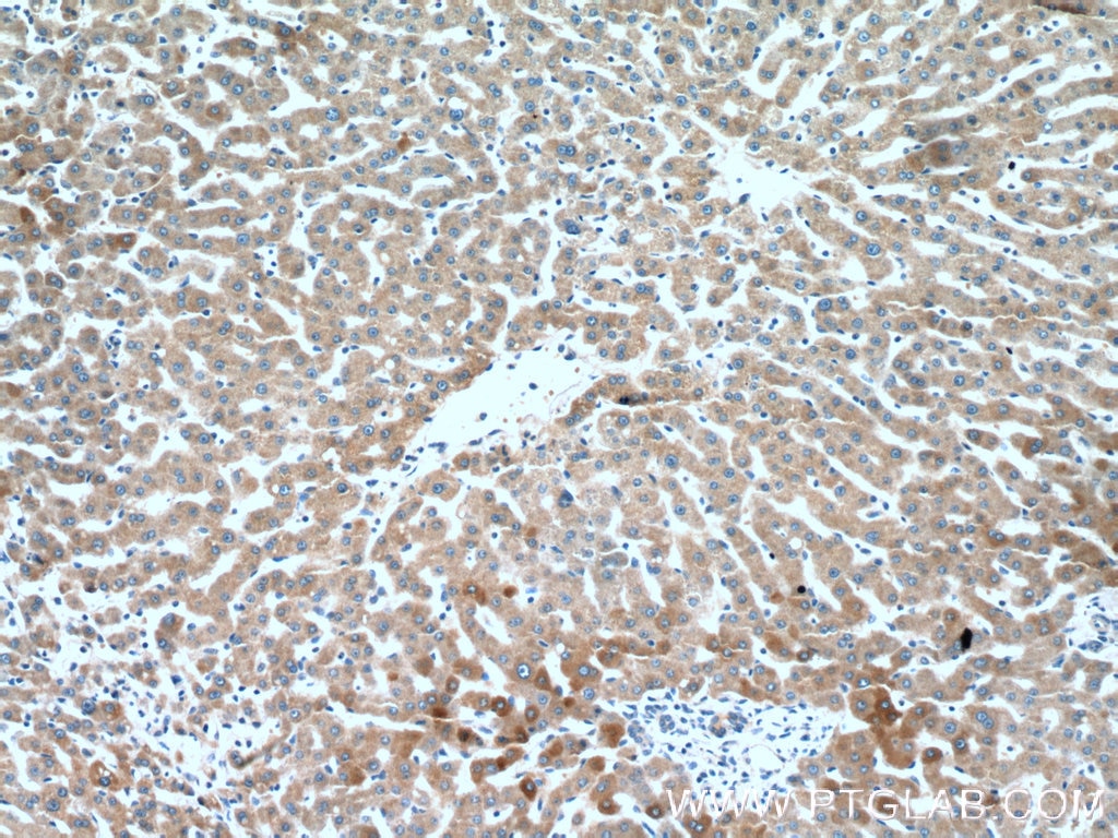 Immunohistochemistry (IHC) staining of human liver tissue using CRP Monoclonal antibody (66250-1-Ig)