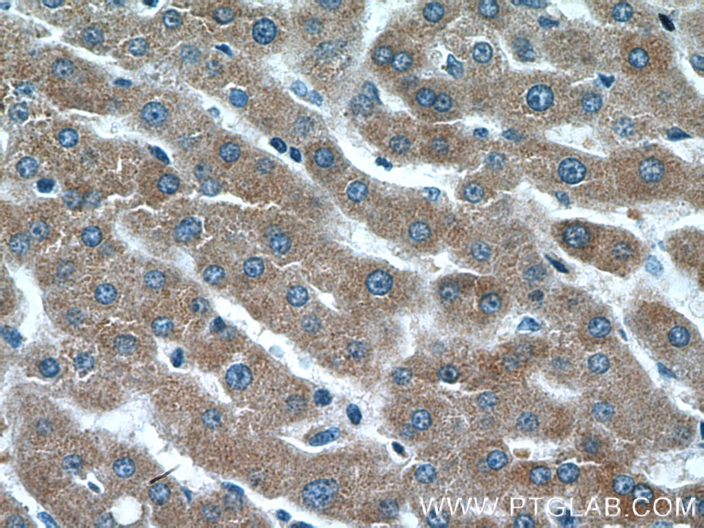 Immunohistochemistry (IHC) staining of human liver tissue using CRP Monoclonal antibody (66250-1-Ig)