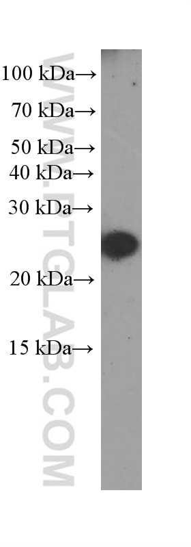 Western Blot (WB) analysis of serum from mouse injected with bacteria using CRP Monoclonal antibody (66250-1-Ig)