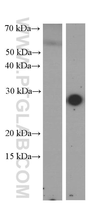 Western Blot (WB) analysis of serum from mouse injected with bacteria using CRP Monoclonal antibody (66250-1-Ig)