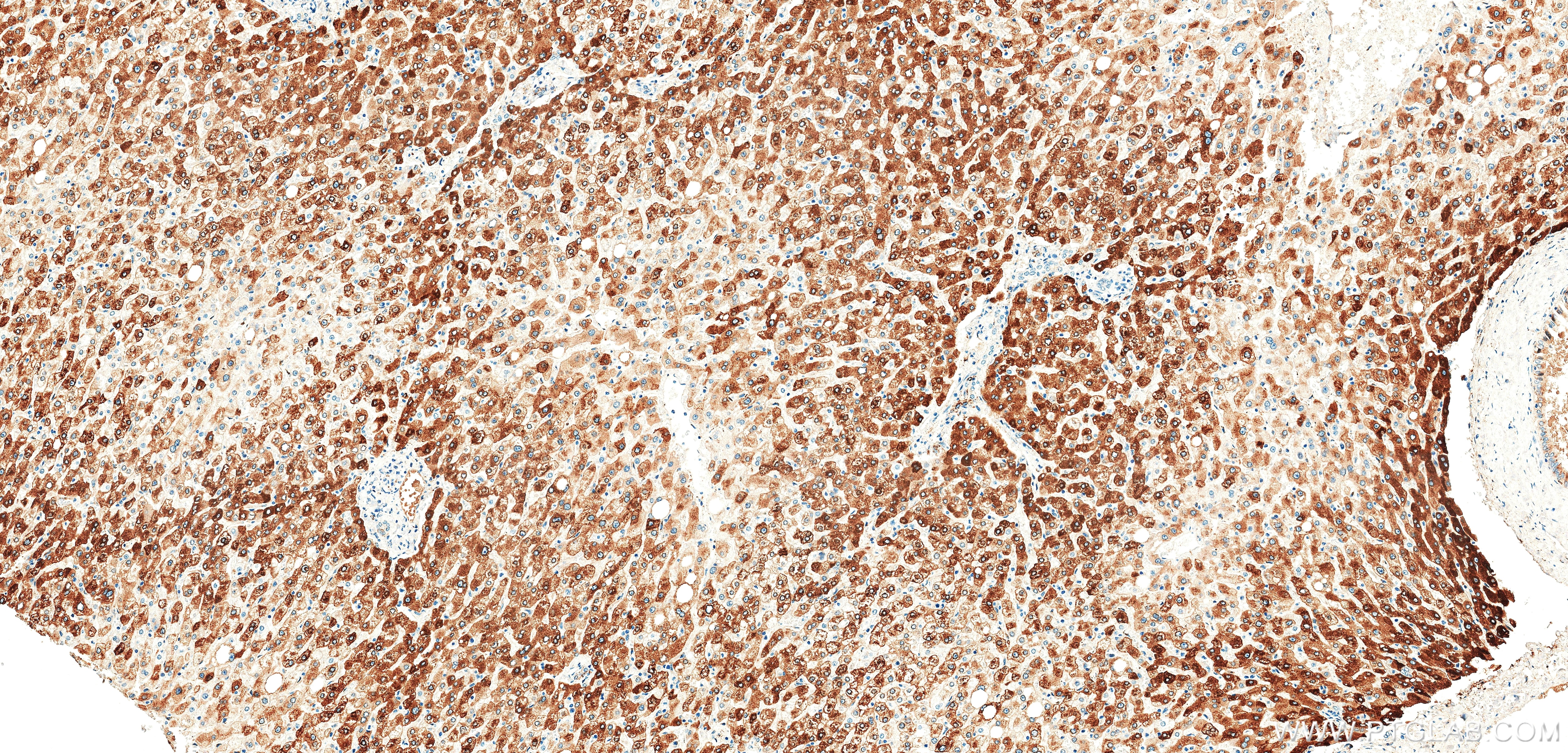 IHC staining of human liver using 86912-6-RR (same clone as 86912-6-PBS) Immunohistochemistry (IHC) staining of human liver tissue using C-Reactive Protein/CRP Recombinant monoclonal anti (86912-6-RR)