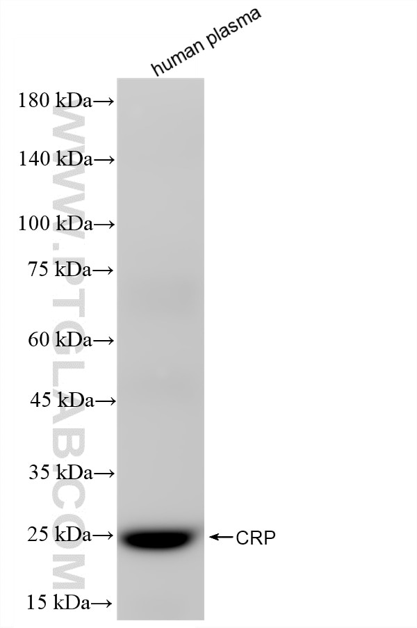 WB analysis using 86912-6-RR (same clone as 86912-6-PBS) Western Blot (WB) analysis of various lysates using C-Reactive Protein/CRP Recombinant monoclonal anti (86912-6-RR)