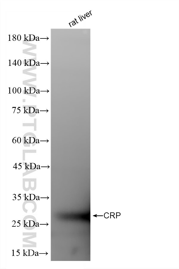 WB analysis using 86912-6-RR (same clone as 86912-6-PBS) Western Blot (WB) analysis of various lysates using C-Reactive Protein/CRP Recombinant monoclonal anti (86912-6-RR)