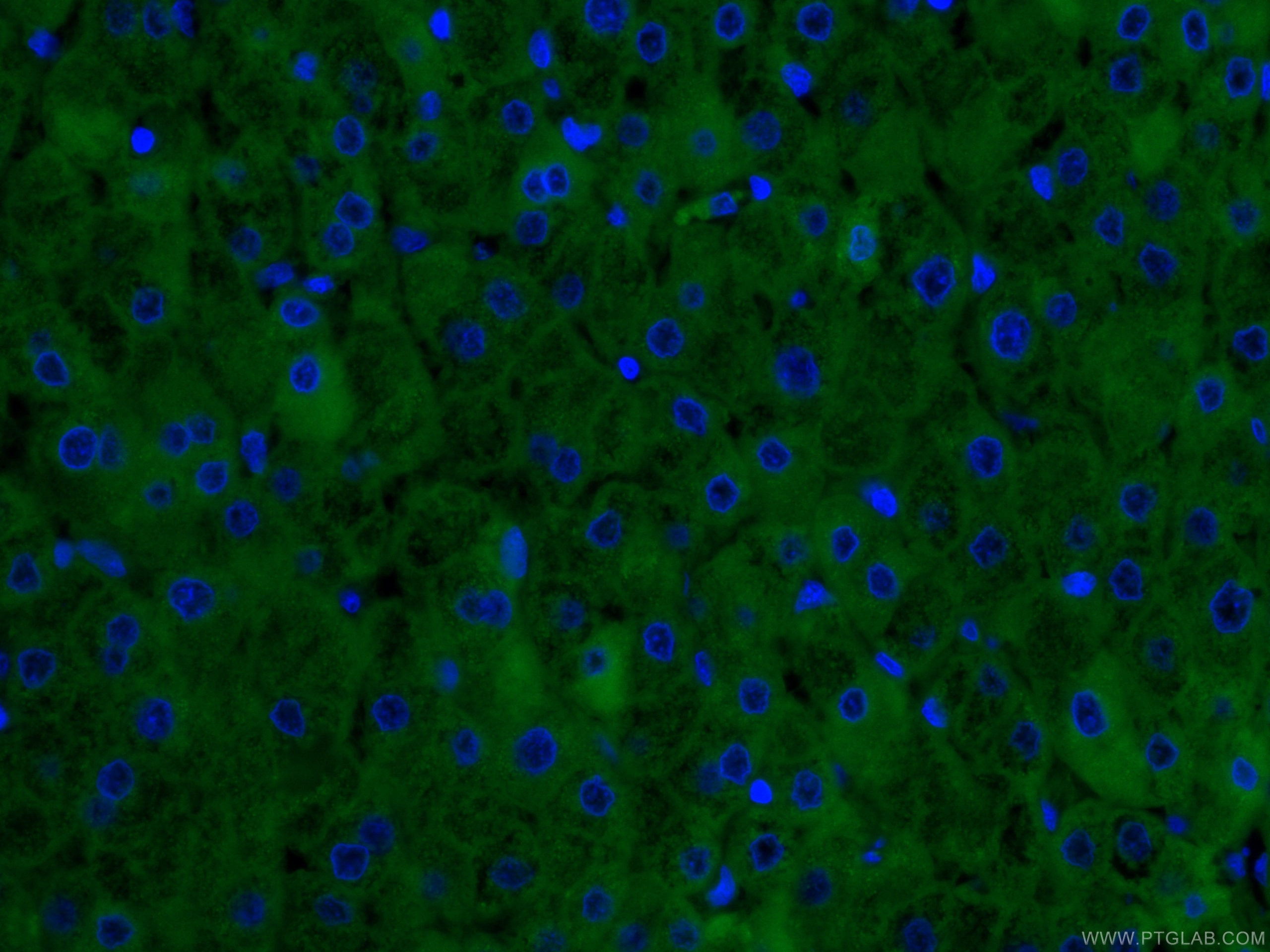 Immunofluorescence (IF) / fluorescent staining of human liver tissue using CoraLite® Plus 488-conjugated CRP Monoclonal antib (CL488-66250)