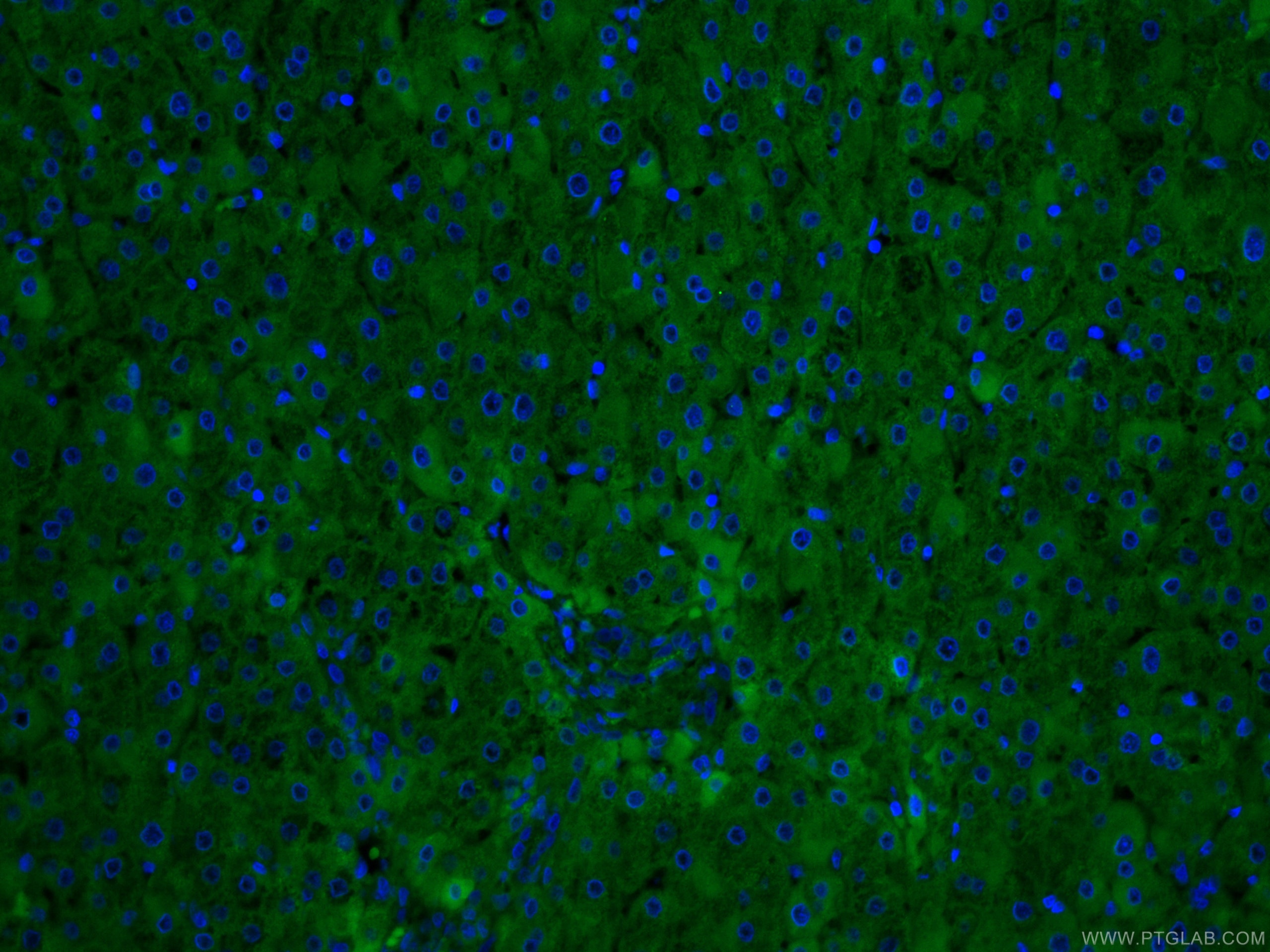 Immunofluorescence (IF) / fluorescent staining of human liver tissue using CoraLite® Plus 488-conjugated CRP Monoclonal antib (CL488-66250)