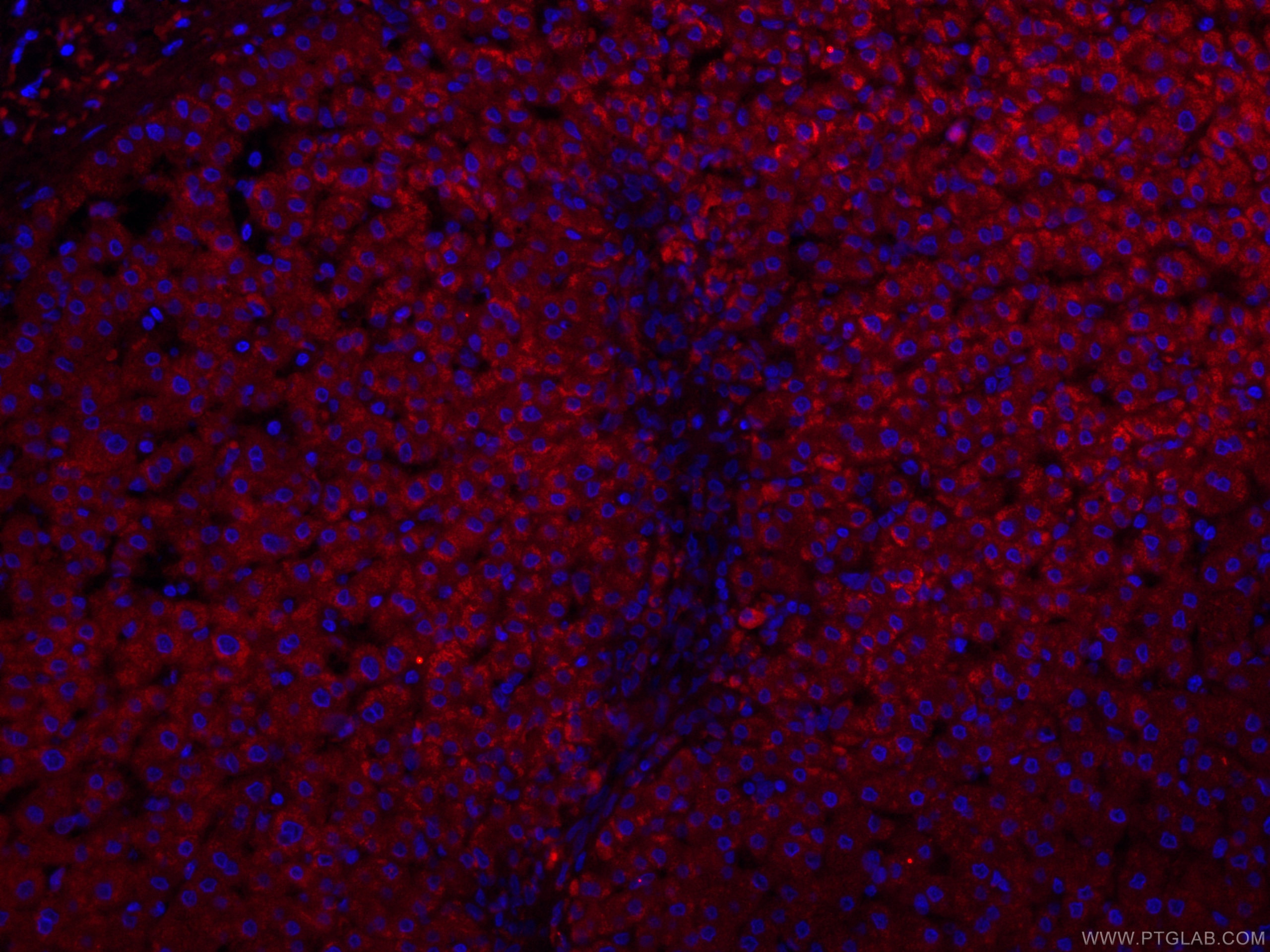 Immunofluorescence (IF) / fluorescent staining of human liver tissue using CoraLite®594-conjugated CRP Monoclonal antibody (CL594-66250)