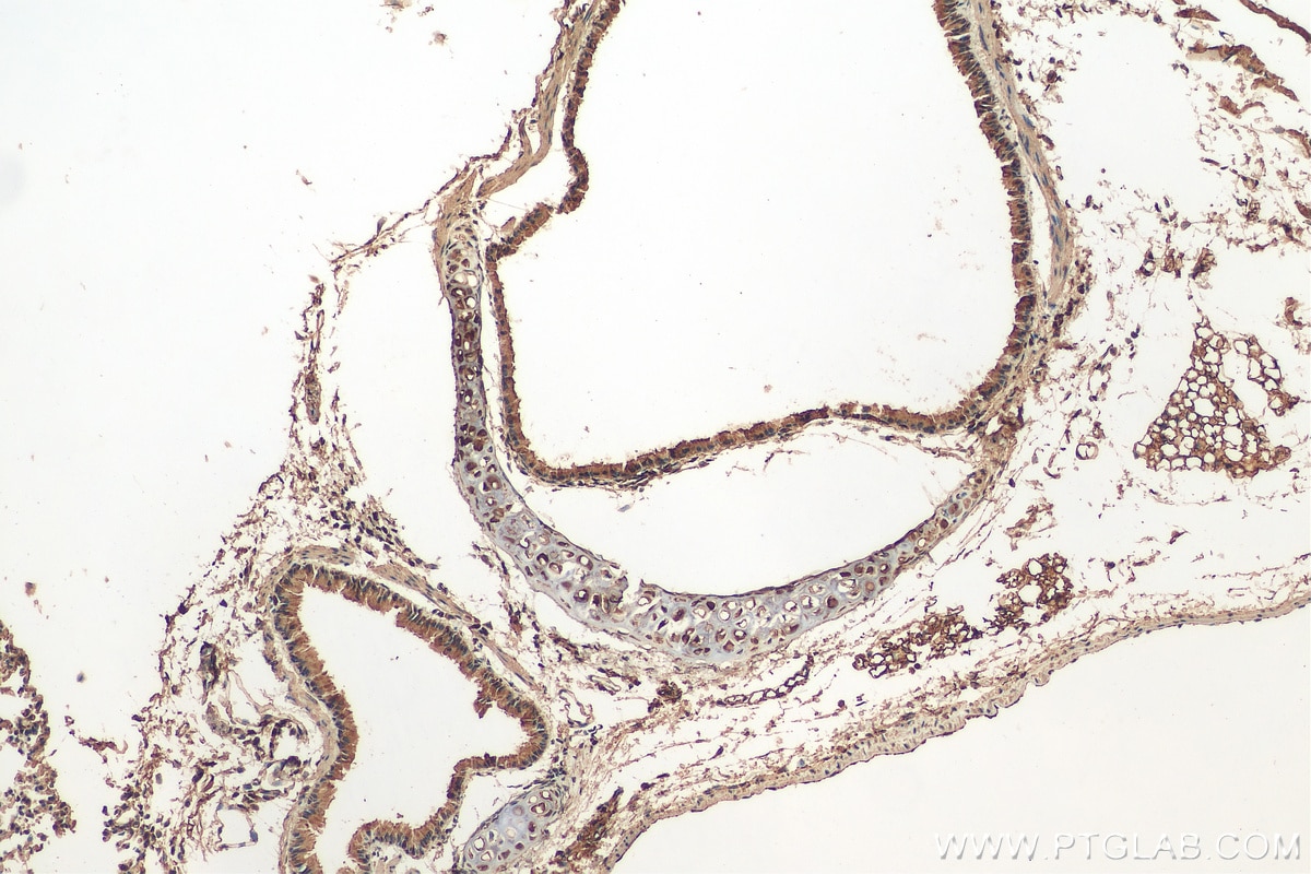 Immunohistochemistry (IHC) staining of mouse lung tissue using CRTAC1 Polyclonal antibody (13001-1-AP)