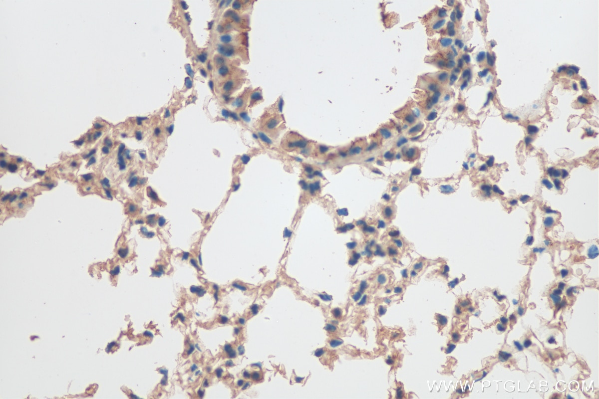 IHC staining of mouse lung using 13001-1-AP