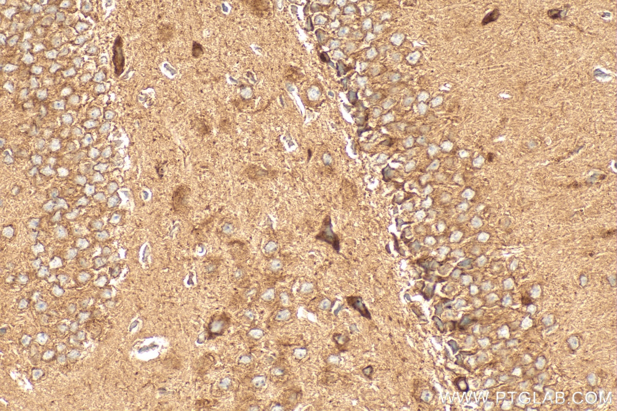 Immunohistochemistry (IHC) staining of mouse brain tissue using CRTAC1 Polyclonal antibody (13001-1-AP)