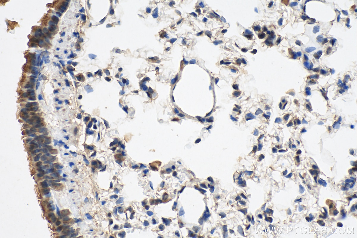 Immunohistochemistry (IHC) staining of rat lung tissue using CRTAC1 Polyclonal antibody (13001-1-AP)