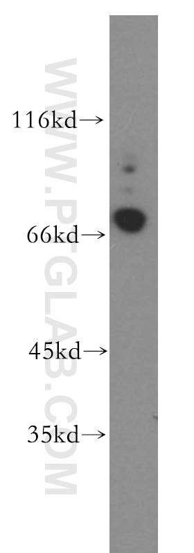 Western Blot (WB) analysis of human brain tissue using CRTAC1 Polyclonal antibody (13001-1-AP)