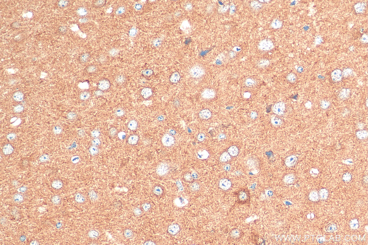 Immunohistochemistry (IHC) staining of mouse brain tissue using CRTAC1 Polyclonal antibody (30251-1-AP)