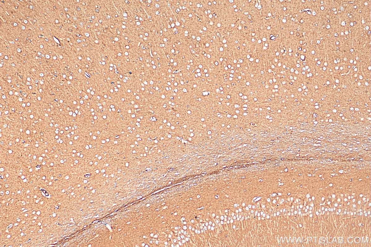 Immunohistochemistry (IHC) staining of rat brain tissue using CRTAC1 Polyclonal antibody (30251-1-AP)