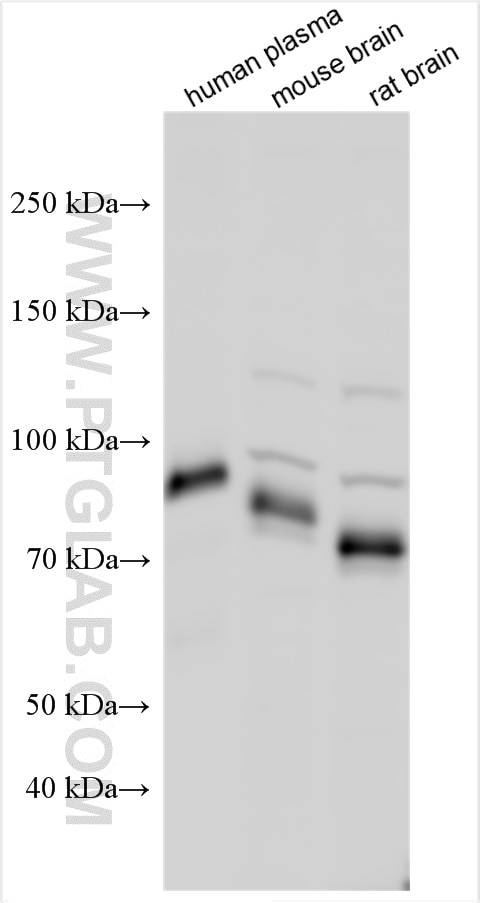 Western Blot (WB) analysis of various lysates using CRTAC1 Polyclonal antibody (30251-1-AP)