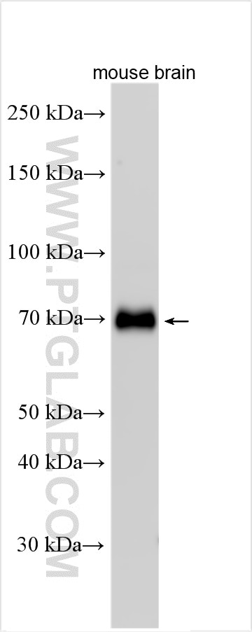 Western Blot (WB) analysis of various lysates using CRTAC1 Polyclonal antibody (30251-1-AP)