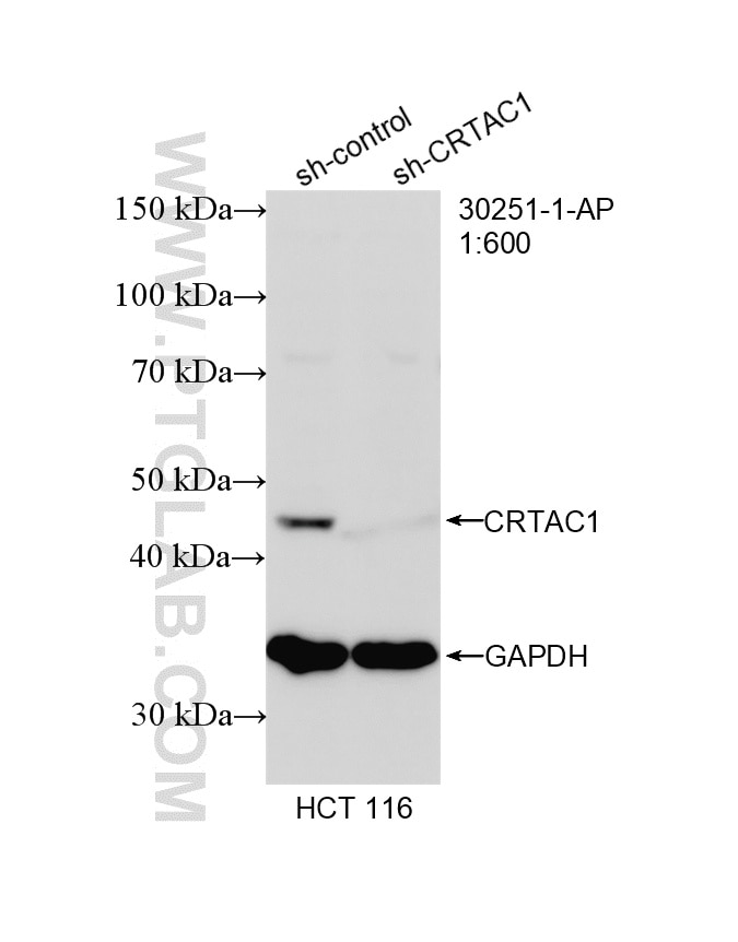 Western Blot (WB) analysis of HCT 116 cells using CRTAC1 Polyclonal antibody (30251-1-AP)